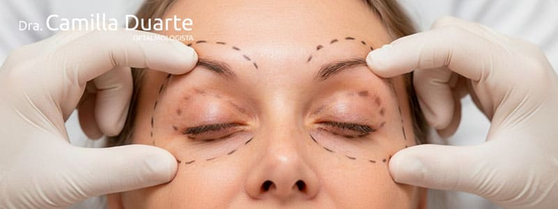 avaliação de palpebras para plastica ocular