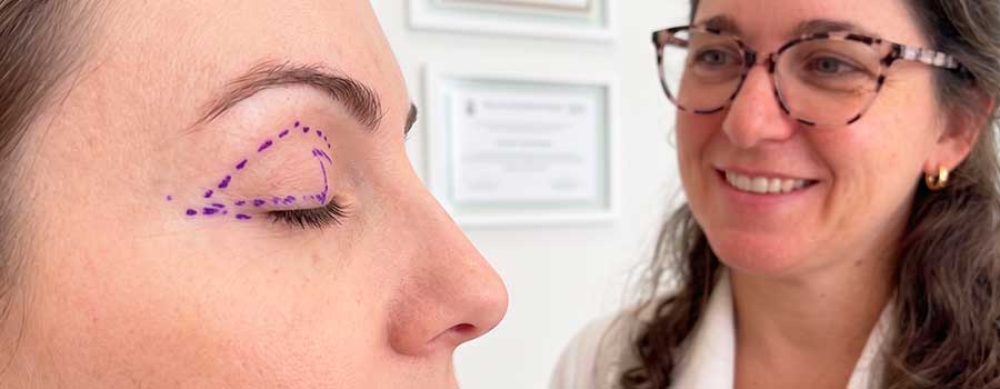 ptose palpebral sendo avaliada pela oftalmologista