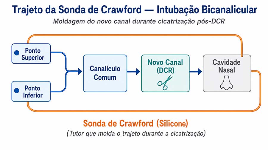 diagrama sonda crawford